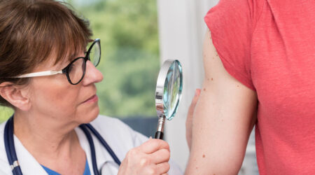 10 Important Questions to Ask a Dermatologist