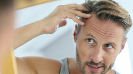 7 Medical Conditions That Can Trigger Hair Loss