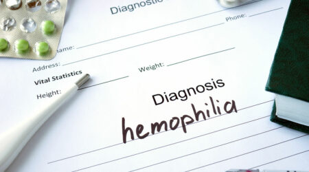 8 signs and symptoms of hemophilia