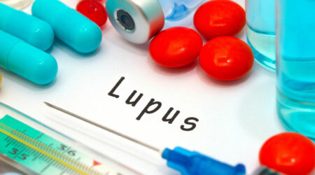Avoid These 12 Triggers to Manage Lupus